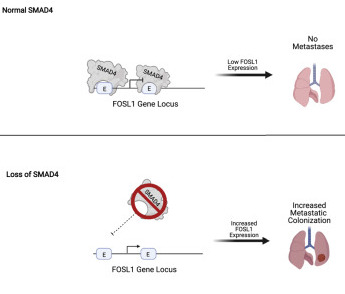 SMAD4 represses FOSL1 expression and pancreatic cancer metastatic colonization